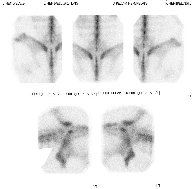 Equine Pelvis