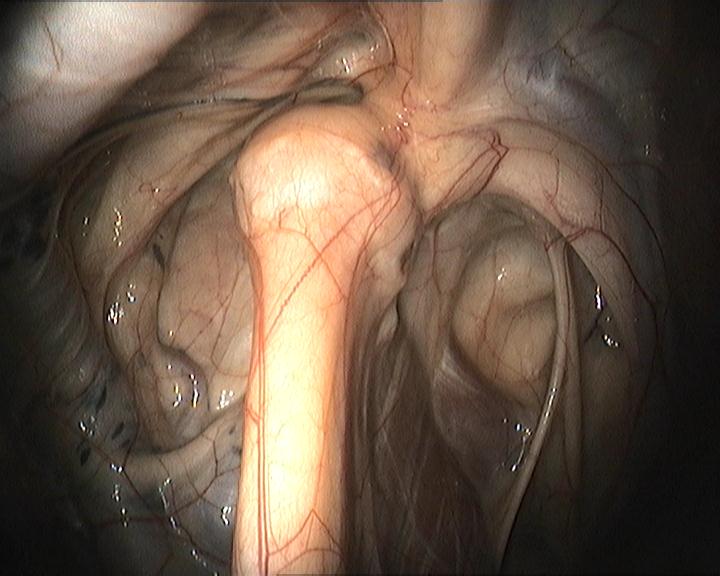 Endoscopy at Endell Equine